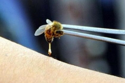 梦见蜜蜂蛰自已是什么意思